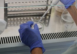 Nové laboratorní technologie rychle rozpoznají tisíce druhů mikroorganismů