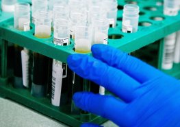 Aktualita OKBD OUN – NT-proBNP