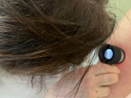 Den melanomu v Litomyšlské nemocnici