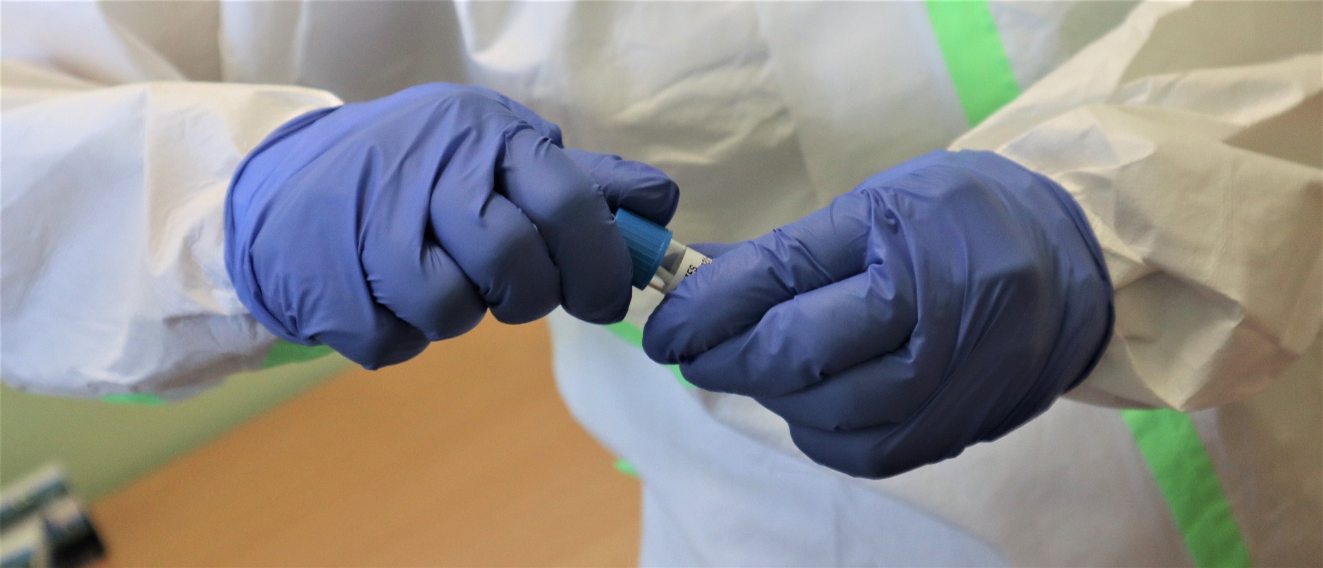 Laboratorní kapacity Nemocnice Pardubického kraje jedou na plný plyn, Svitavy začnou s PCR odběry
