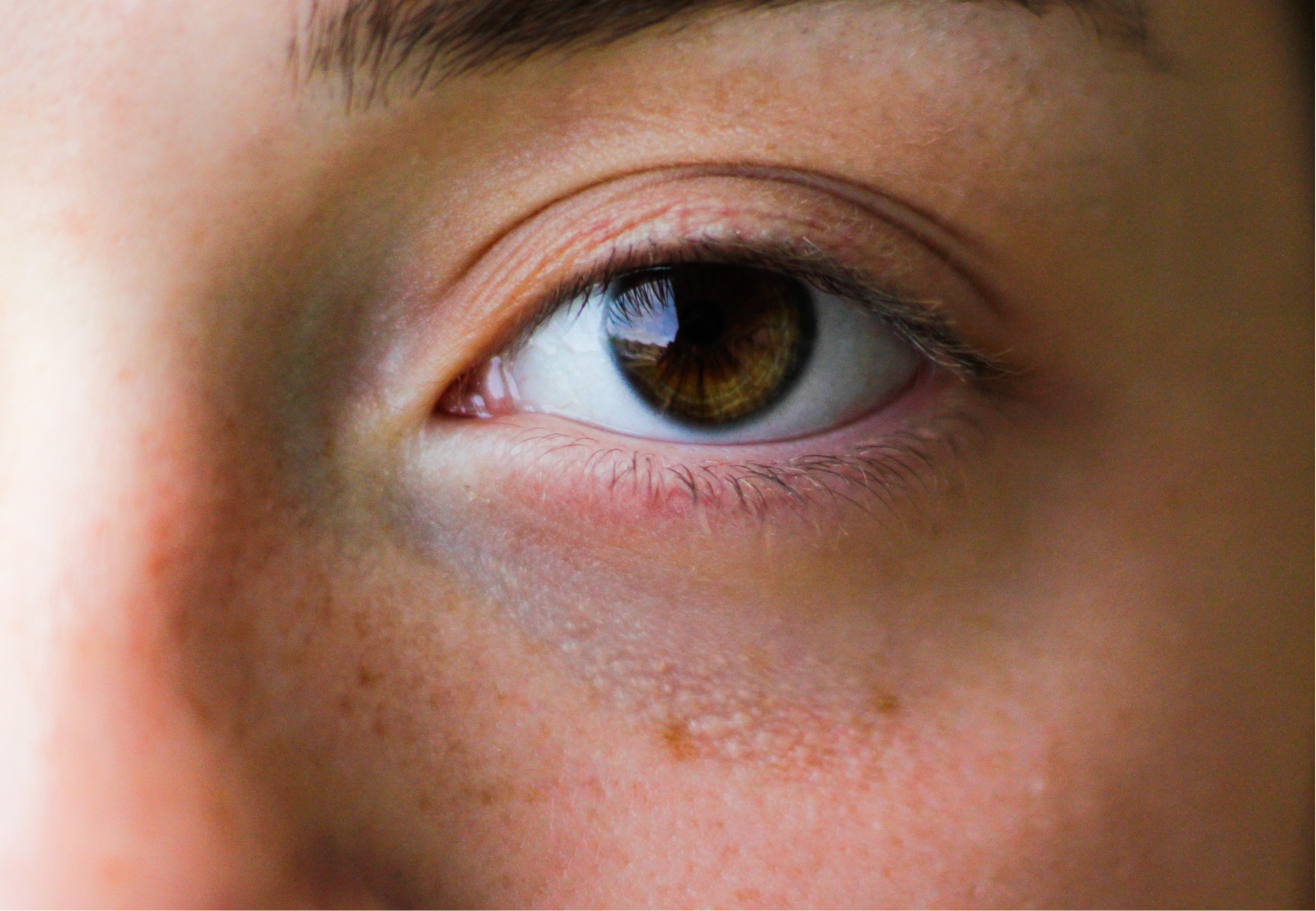 Tichý zabiják zraku se glaukomu nepřezdívá náhodou. Problému se zrakem si pacient ani nemusí všimnout, říká oční lékař