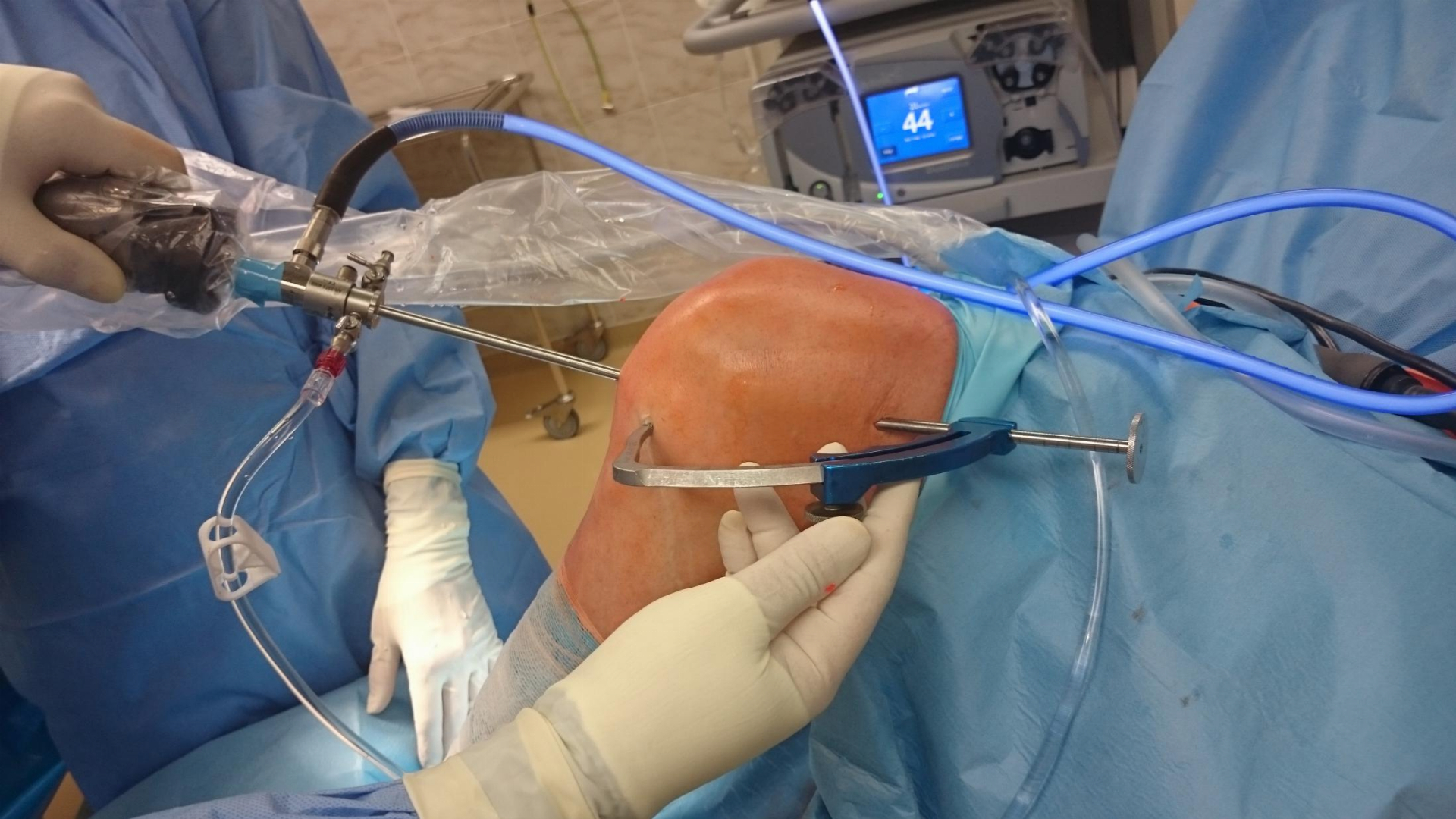 Prestižní mezinárodní kongres v Litomyšli představí nové trendy v artroskopii